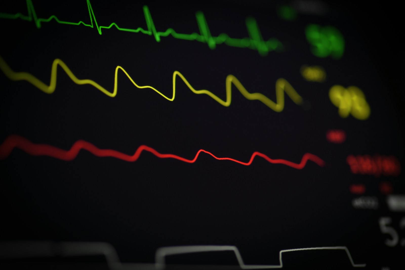 ECG-style live signal representing continuous outcome governance